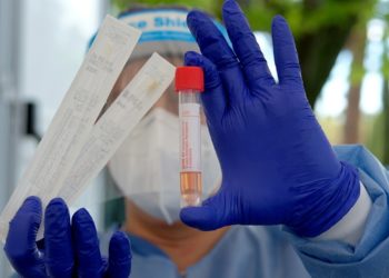 Exames do Lacen descarta presença da variante Delta em paciente do Piauí