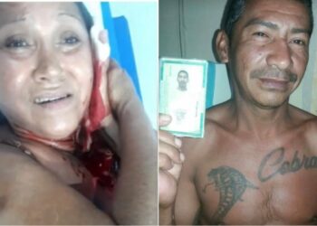 Homem desfere golpes de facão contra ex-companheira em Campo Maior (PI)