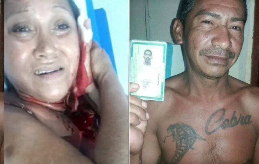 Homem desfere golpes de facão contra ex-companheira em Campo Maior (PI)