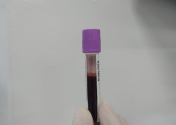 Hemopi realiza campanha para cadastro de doadores de medula óssea no interior