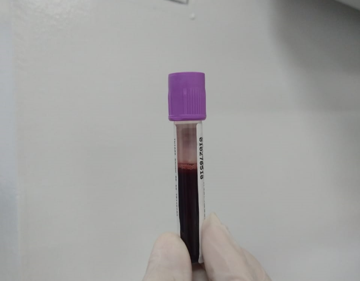 Hemopi realiza campanha para cadastro de doadores de medula óssea no interior