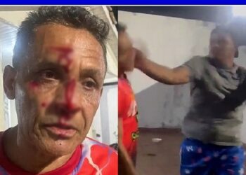 Filho agride o pai com soco na cabeça por não emprestar carro; veja vídeo