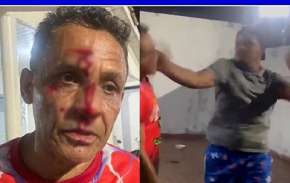 Filho agride o pai com soco na cabeça por não emprestar carro; veja vídeo