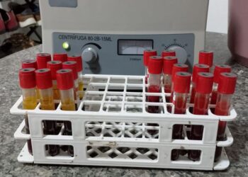 Laboratório Federal comprova que não há circulação do vírus da febre aftosa no Piauí